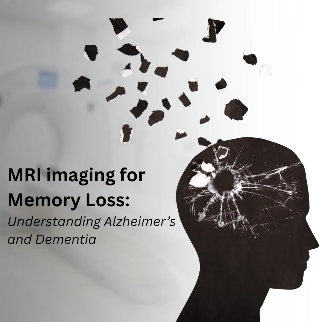 MRI imaging showing brain changes related to memory loss, Alzheimer’s, and dementia diagnosis.