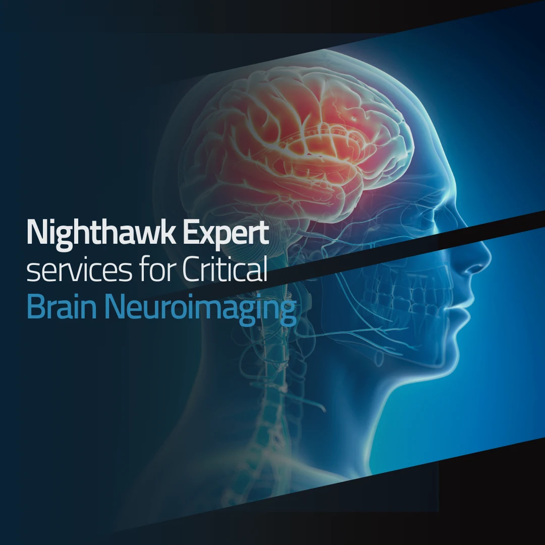 Brain scan showing Nighthawk expert brain neuroimaging services.