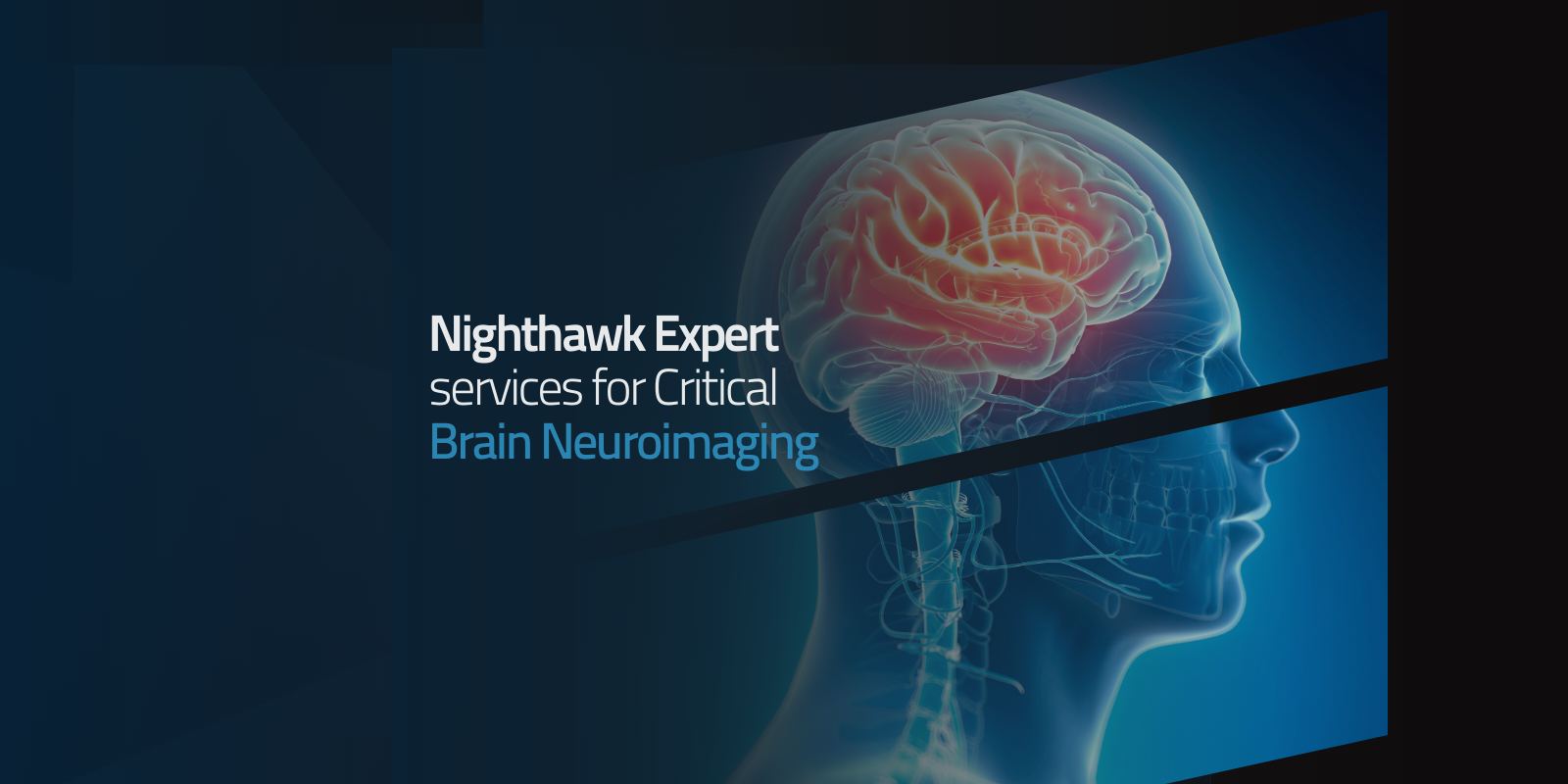 Brain scan showing Nighthawk expert brain neuroimaging services.