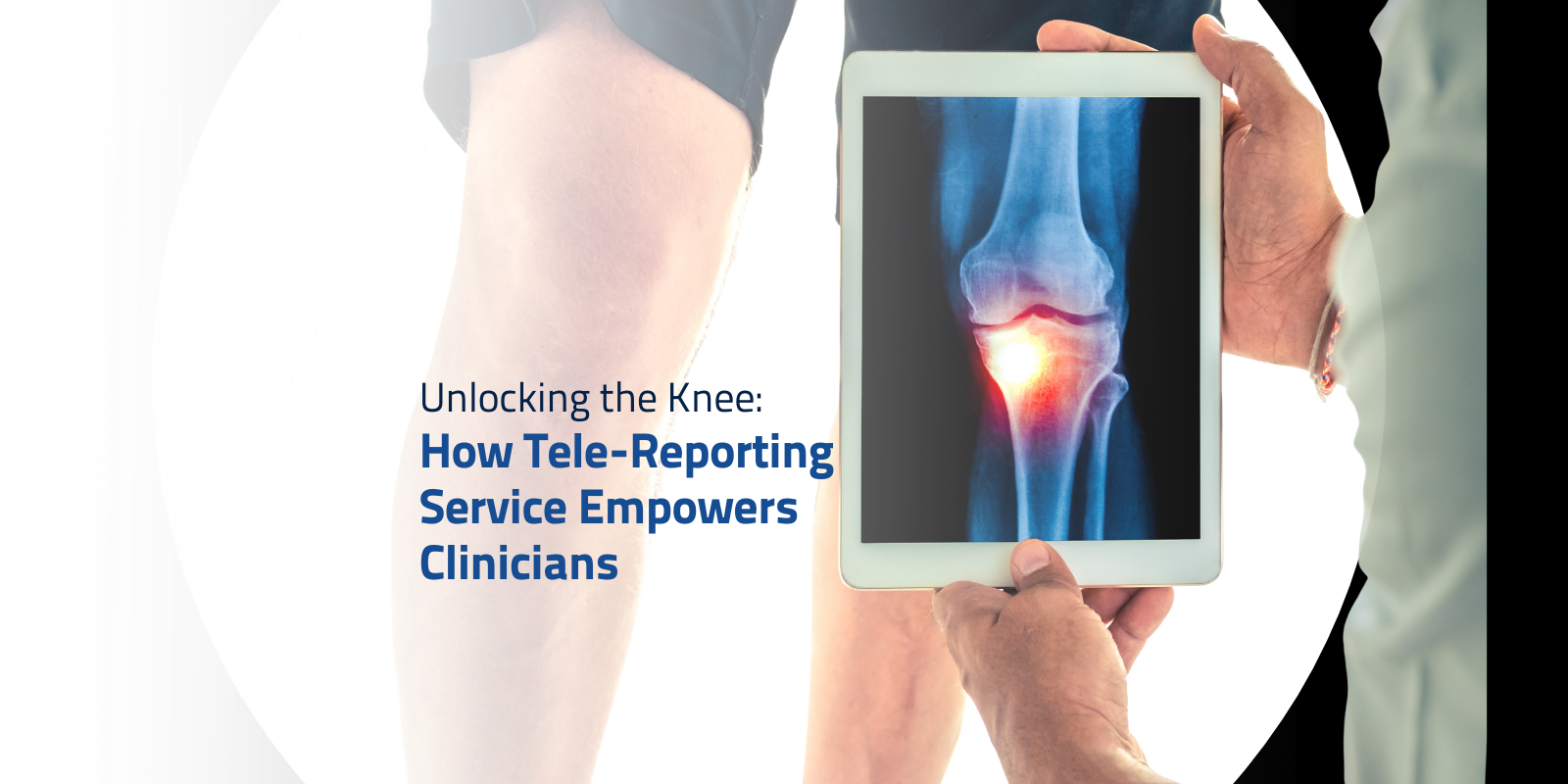Clinician reviewing a knee X-ray on a tablet using a Tele-Reporting Service.