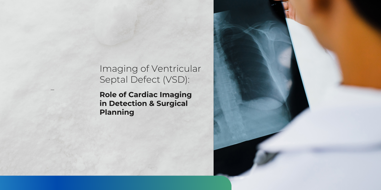 Doctor reviewing cardiac imaging report for ventricular septal defect (VSD) diagnosis and surgical planning