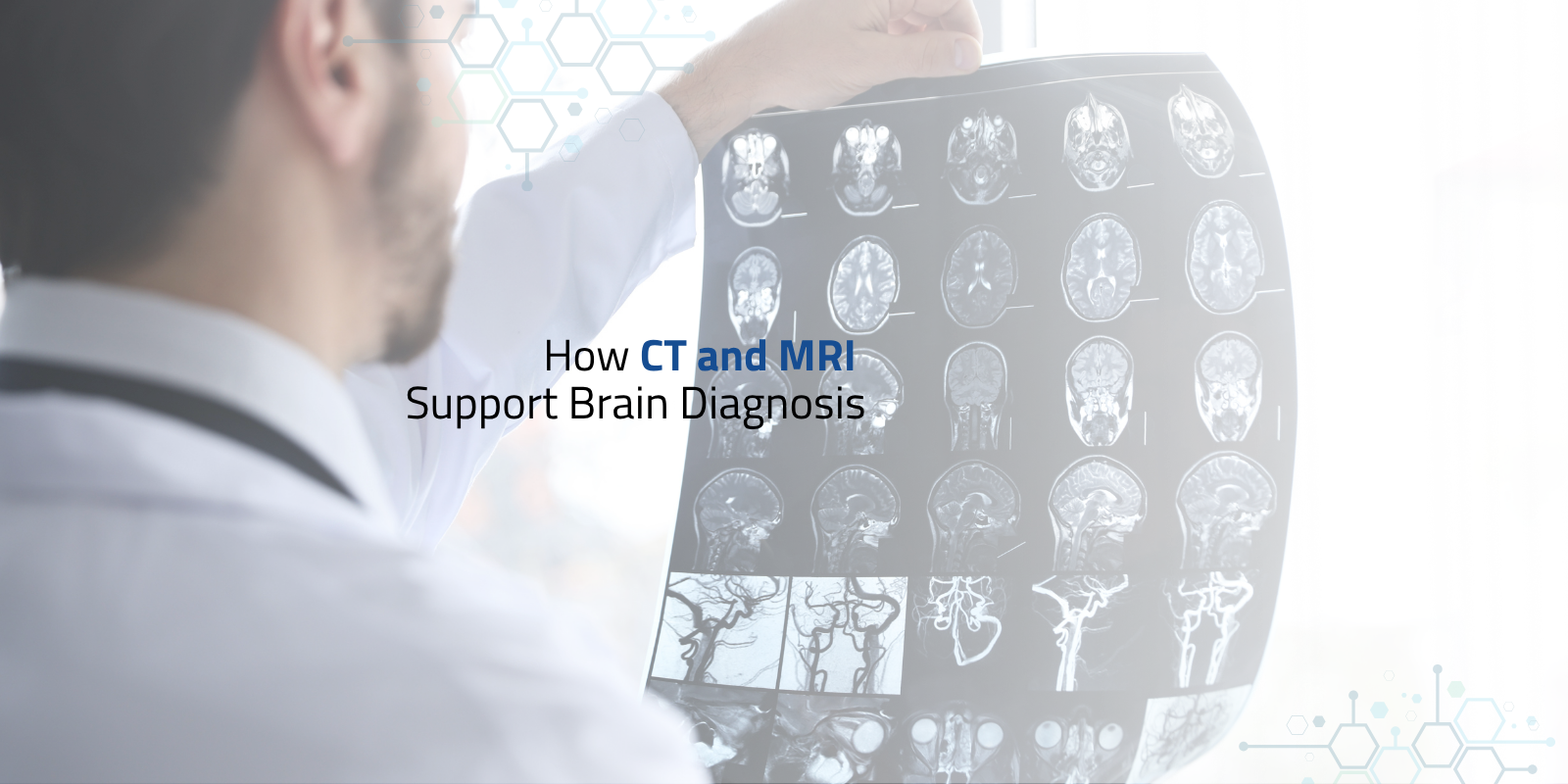 Doctor reviewing CT MRI imaging brain scan report for diagnosis