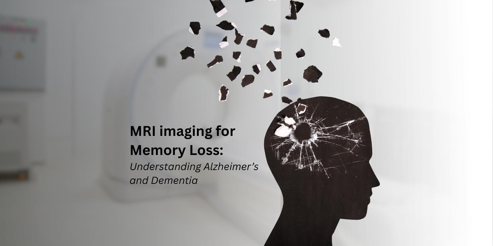 MRI imaging showing brain changes related to memory loss, Alzheimer’s, and dementia diagnosis.