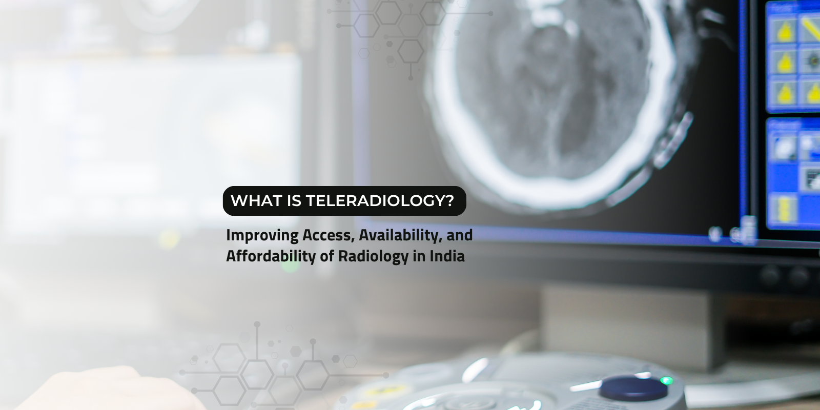 Teleradiology setup showing radiologist analyzing brain scan on medical imaging workstation to improve access and availability of radiology services in India