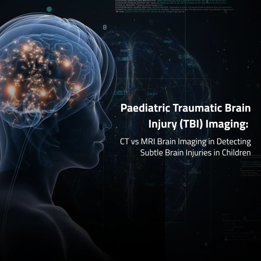 Paediatric brain injury illustration highlighting CT vs MRI brain imaging for detecting subtle brain injuries in children