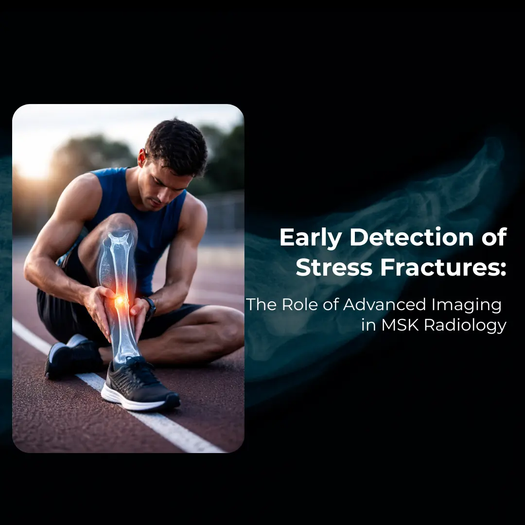 Injured athlete holding his leg, highlighting Musculoskeletal Service for early stress fracture detection.