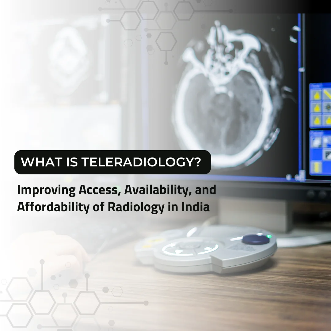 Teleradiology setup showing radiologist analyzing brain scan on medical imaging workstation to improve access and availability of radiology services in India