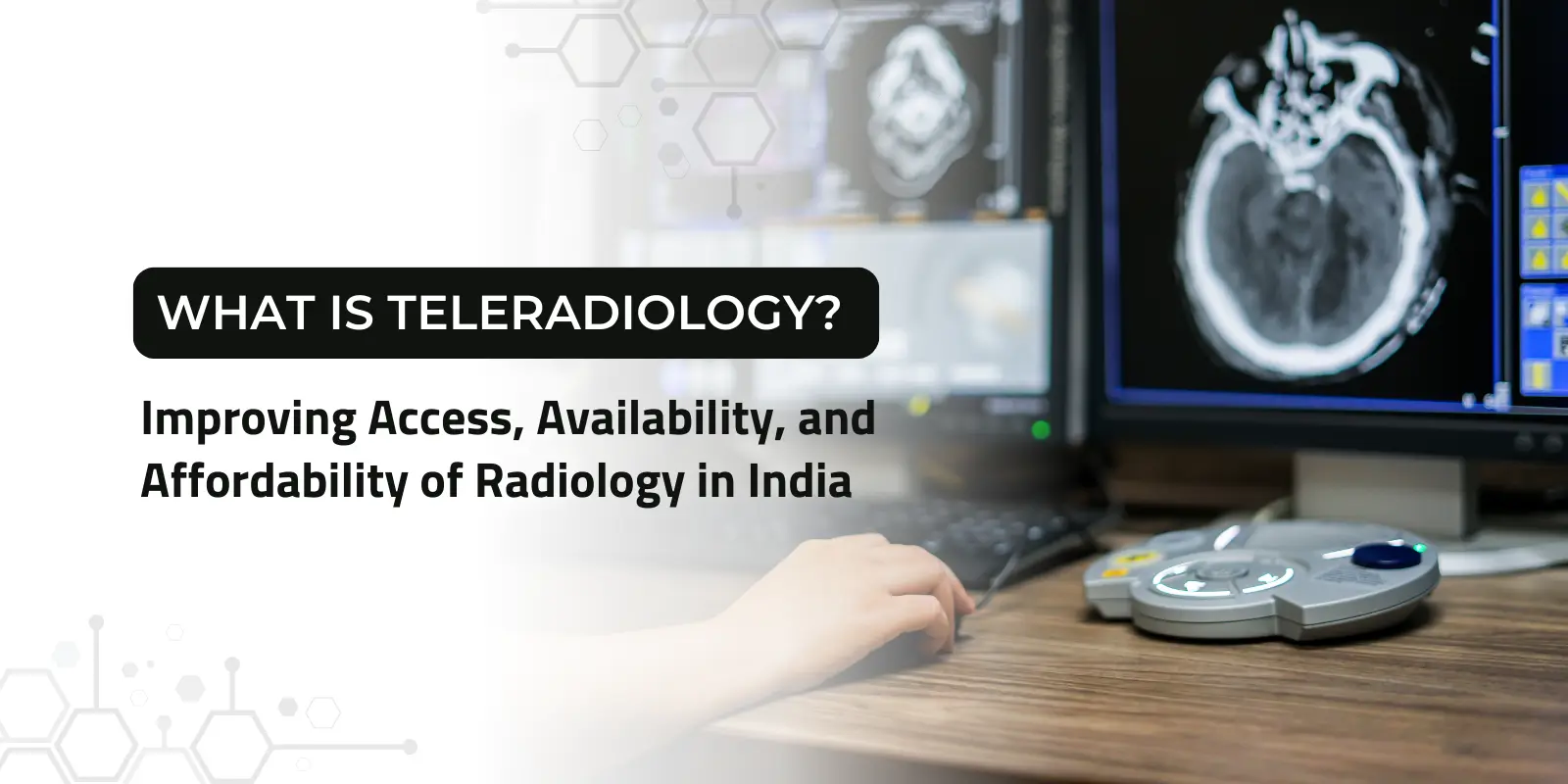 Teleradiology setup showing radiologist analyzing brain scan on medical imaging workstation to improve access and availability of radiology services in India