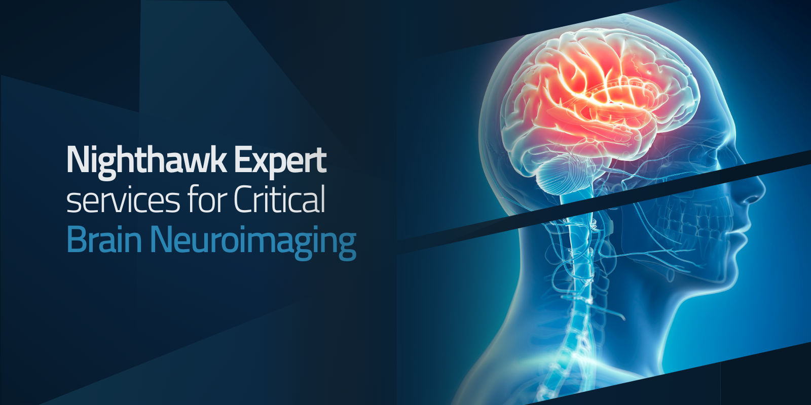 Brain scan showing Nighthawk expert brain neuroimaging services.