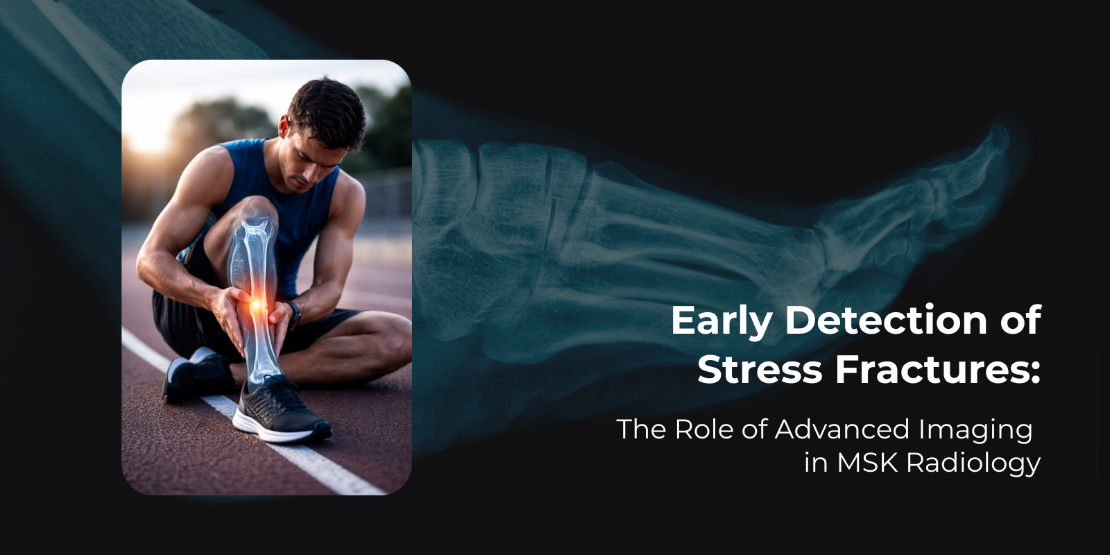 Injured athlete holding his leg, highlighting Musculoskeletal Service for early stress fracture detection.