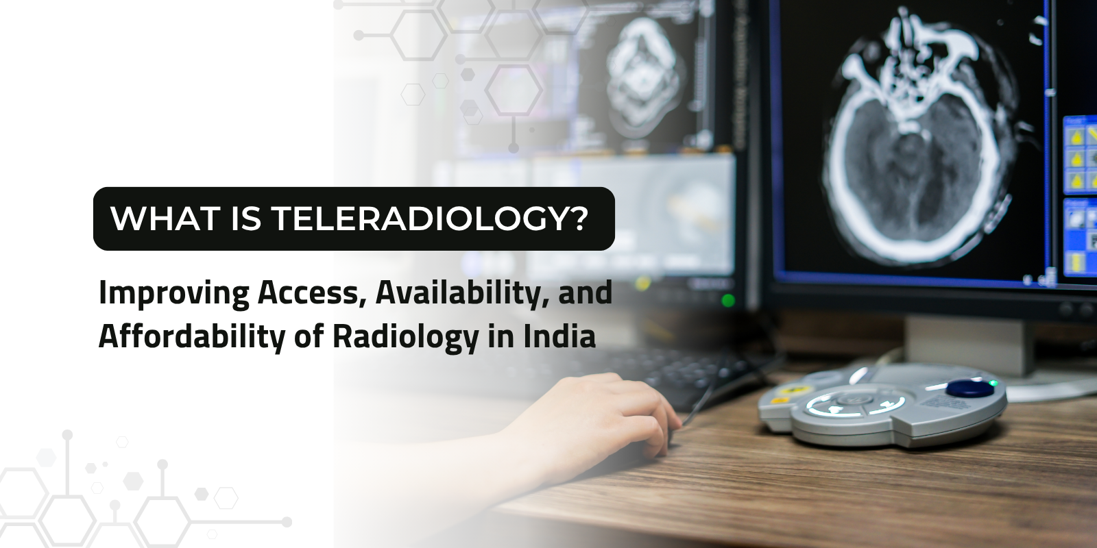 Teleradiology setup showing radiologist analyzing brain scan on medical imaging workstation to improve access and availability of radiology services in India