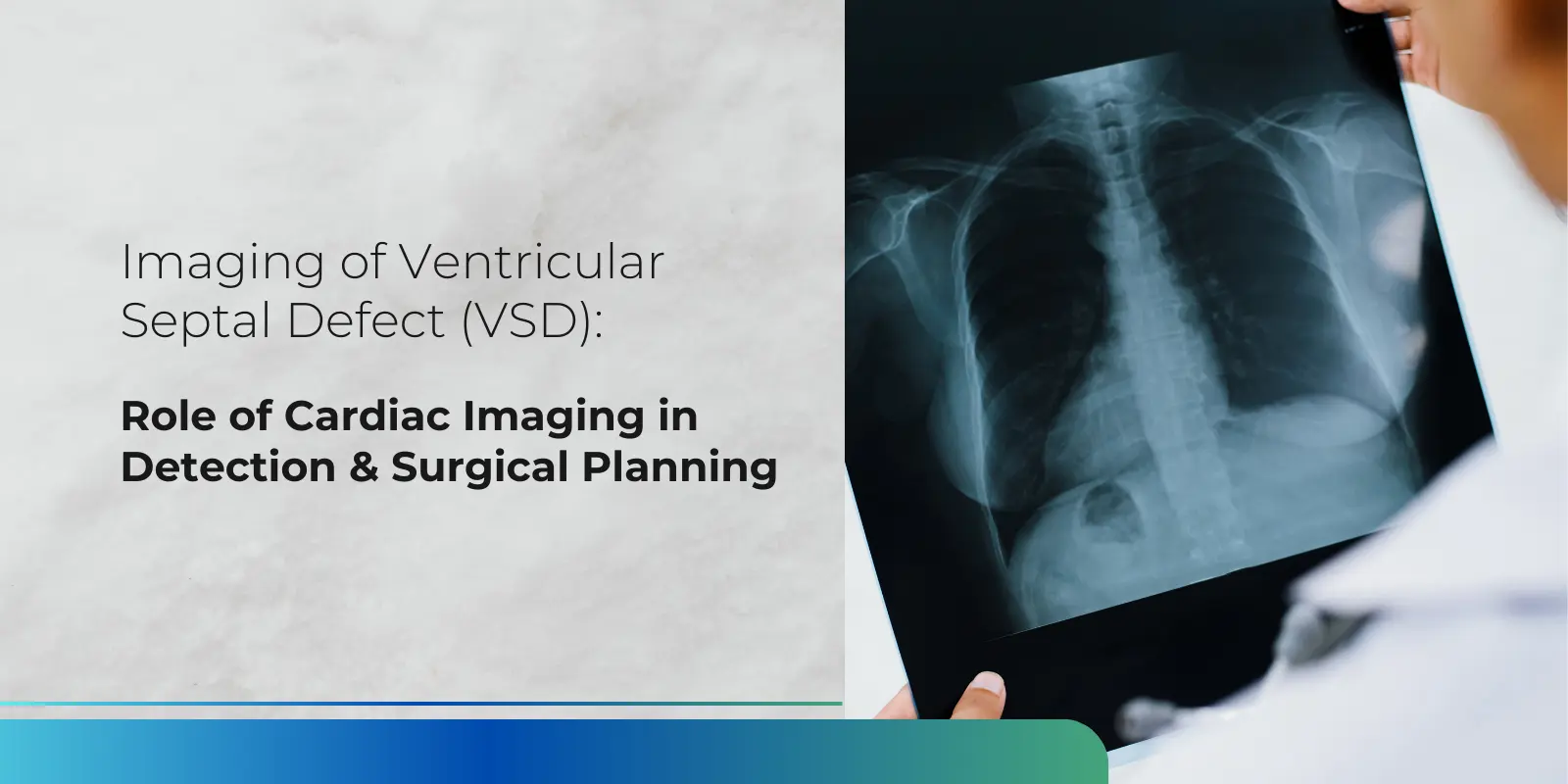 Doctor reviewing cardiac imaging report for ventricular septal defect (VSD) diagnosis and surgical planning