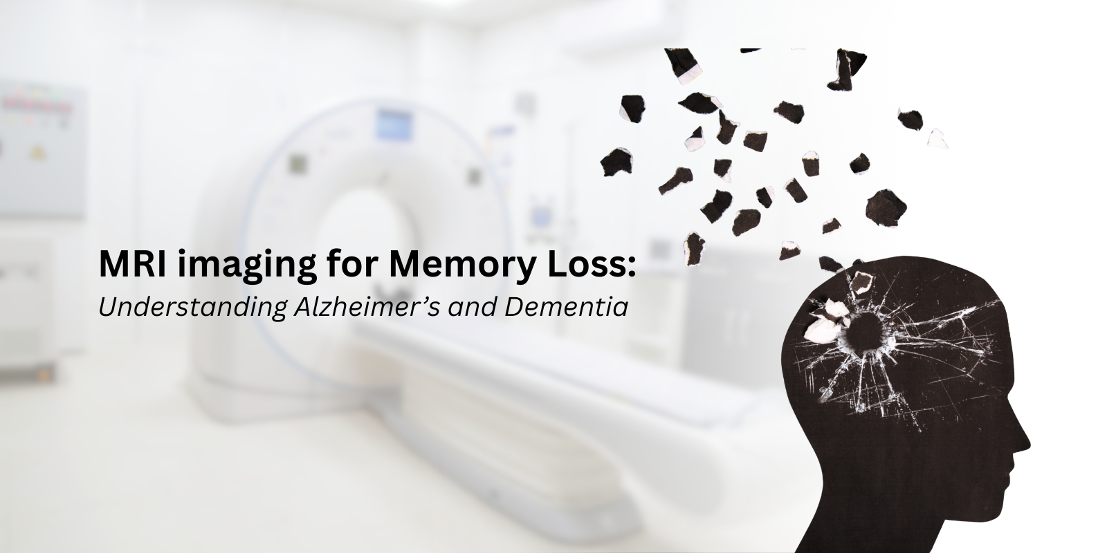 MRI imaging showing brain changes related to memory loss, Alzheimer’s, and dementia diagnosis.