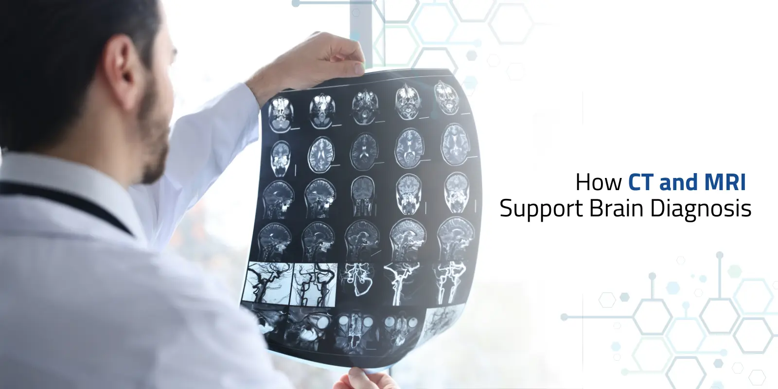 Doctor reviewing CT MRI imaging brain scan report for diagnosis