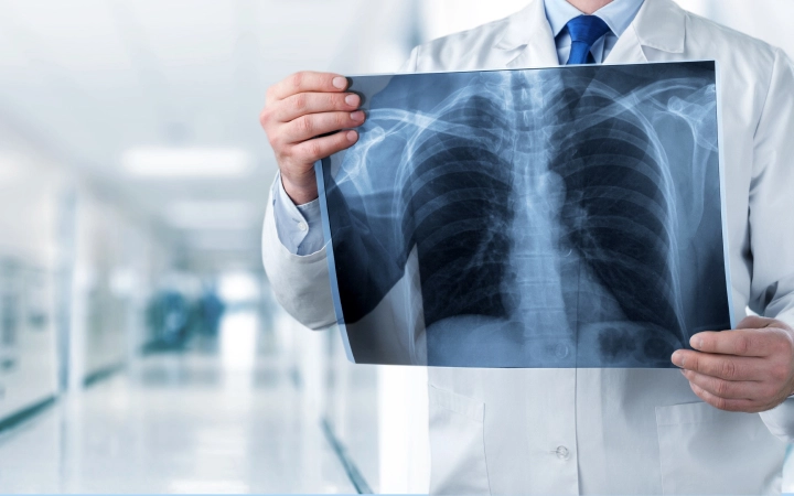 Cardiothoracic imaging Cardiothoracic imaging