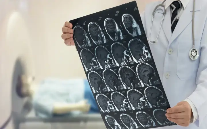 MRI parallel imaging