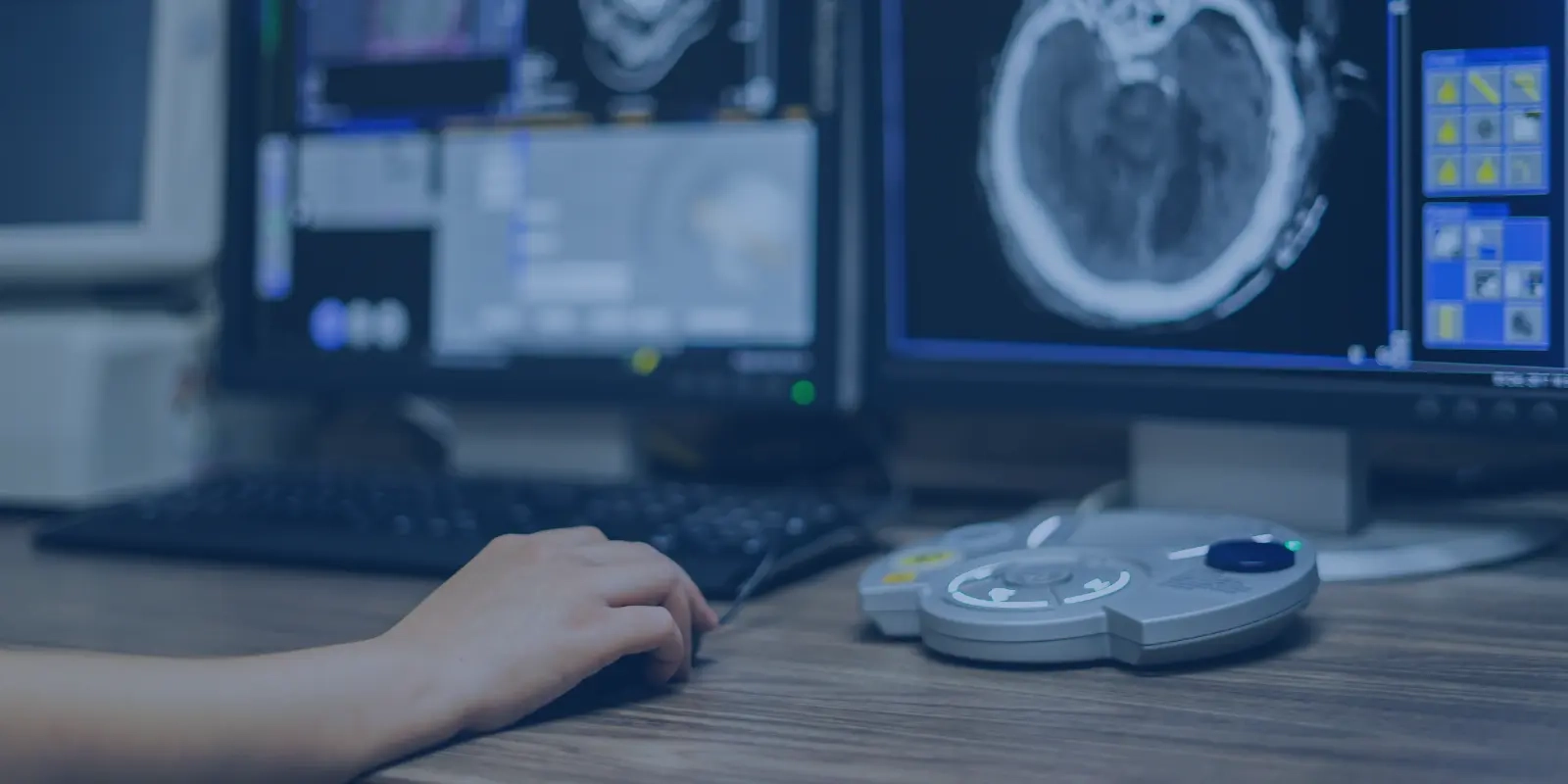 Radiology Online Reporting Interface for Faster Brain Scan Analysis Radiology online reporting system showing brain scan on monitor.
