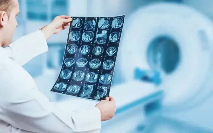 Radiology oncology